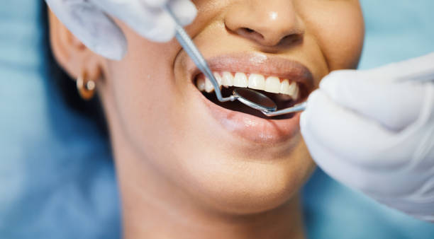 Best Emergency Wisdom Teeth Removal in Huxley, IA